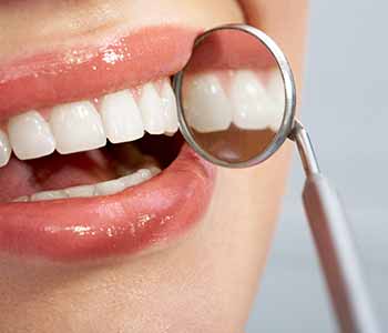 Image of a Brighter teeth