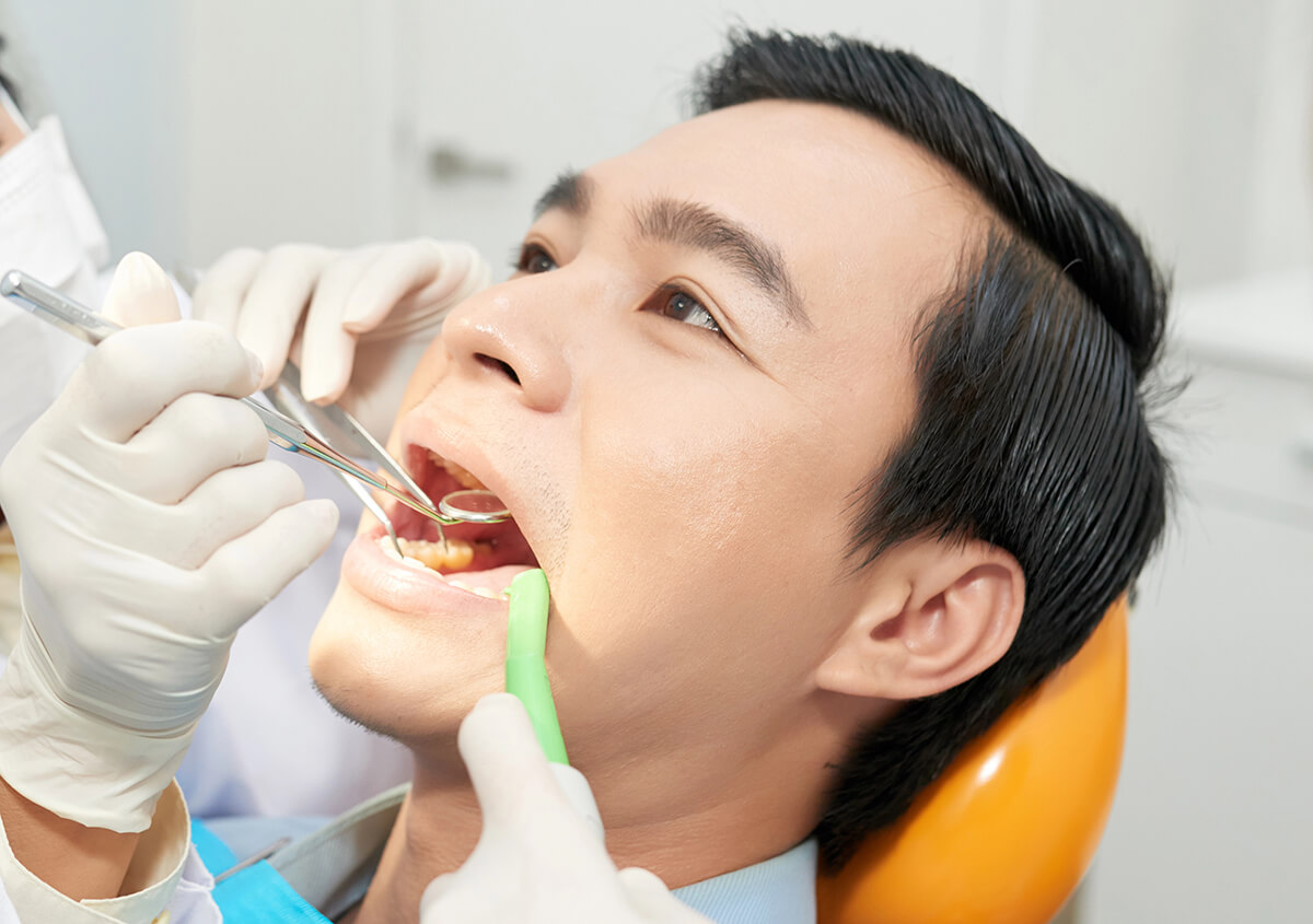 Safe Removal of Mercury Fillings in Dothan AL Area