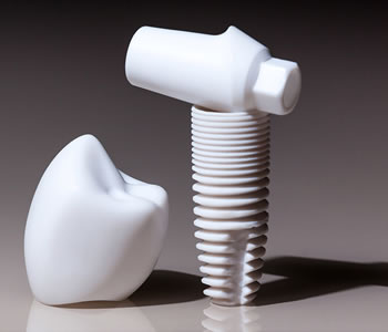 Models of Zirconia Dental Implants at Dothan AL